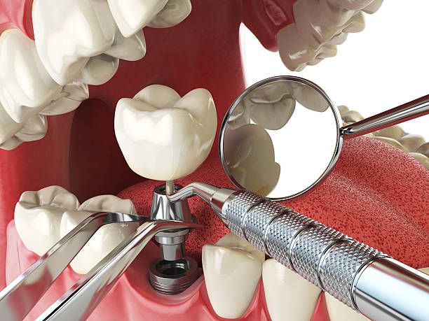 Tooth Infection Emergency Dentist in WI